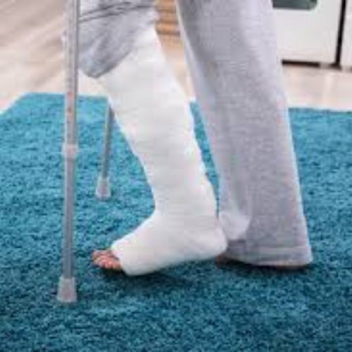 Реабилитация после перелома ноги